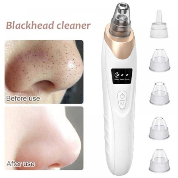 Blackhead Suction Remover Pore Vacuum | Blackhead Pore Cleaning Beauty Tool beauty gadgets ZAR INNOVATIONS 